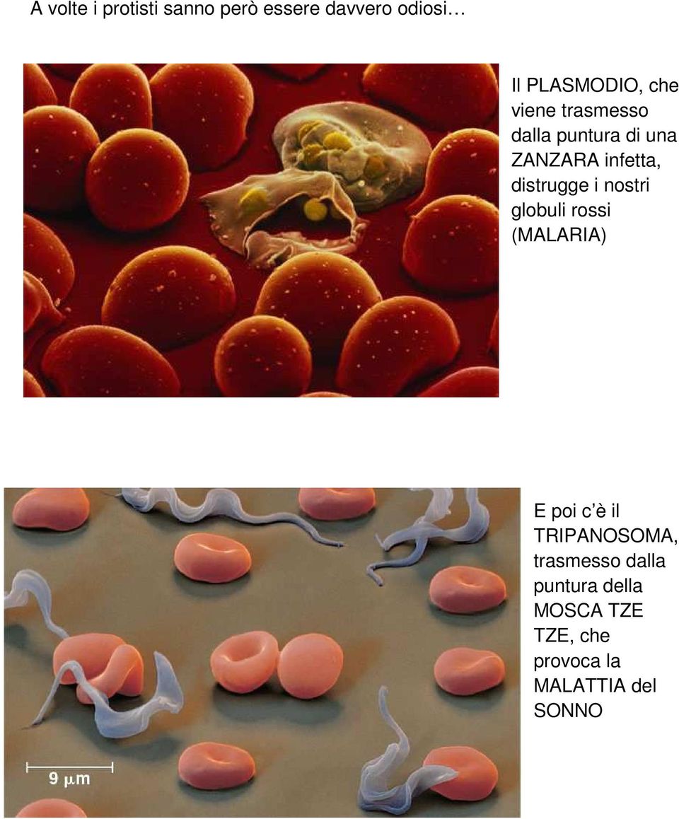 i nostri globuli rossi (MALARIA) E poi c è il TRIPANOSOMA,