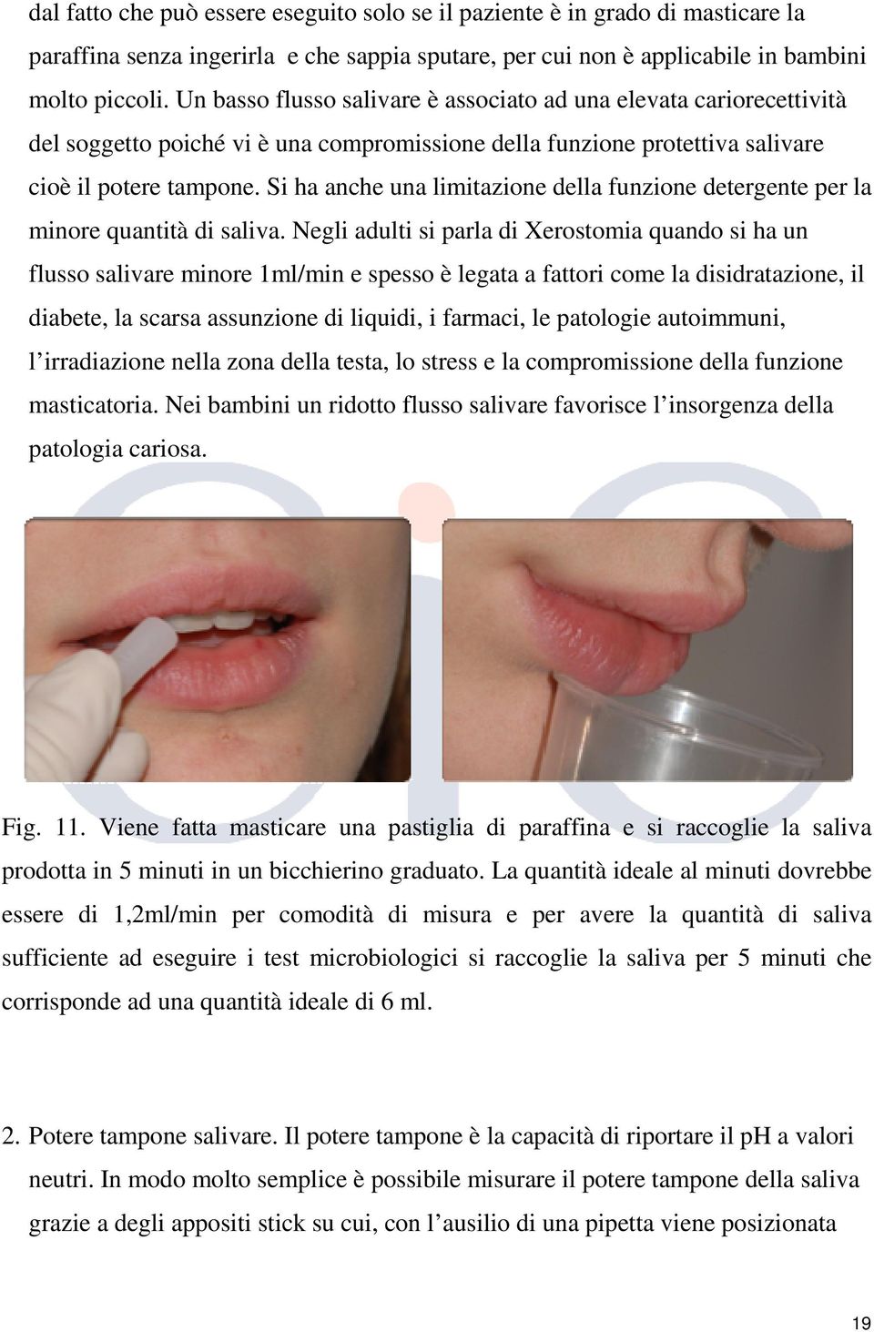 Si ha anche una limitazione della funzione detergente per la minore quantità di saliva.