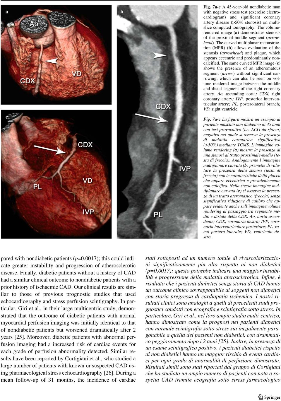 The curved multiplanar reconstruction (MPR) (b) allows evaluation of the stenosis (arrowhead) and plaque, which appears eccentric and predominantly noncalcified.