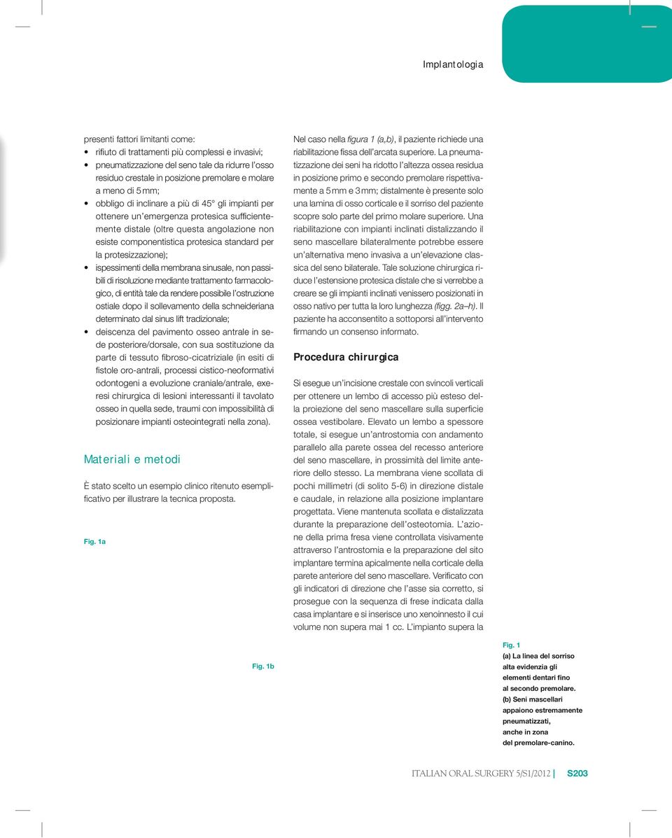 la protesizzazione); ispessimenti della membrana sinusale, non passibili di risoluzione mediante trattamento farmacologico, di entità tale da rendere possibile l ostruzione ostiale dopo il