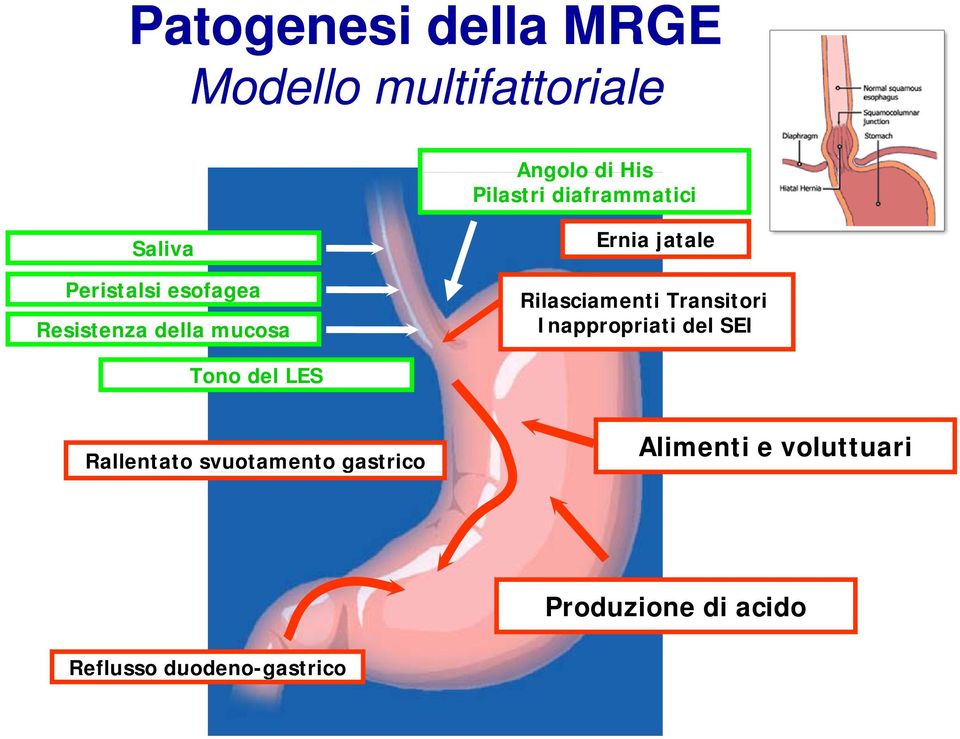 Rilasciamenti Transitori Inappropriati del SEI Tono del LES Rallentato