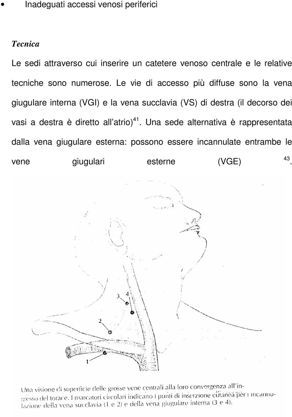 Le vie di accesso più diffuse sono la vena giugulare interna (VGI) e la vena succlavia (VS) di destra (il