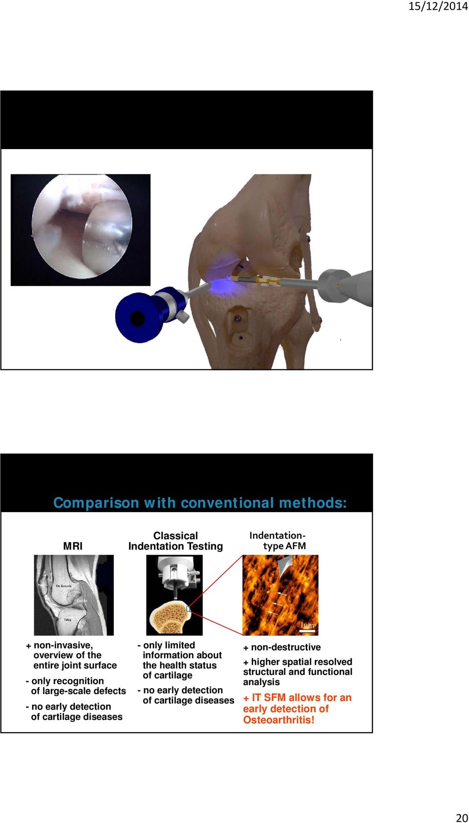 cartilage diseases - only limited information about the health status of cartilage - no early detection of cartilage diseases +