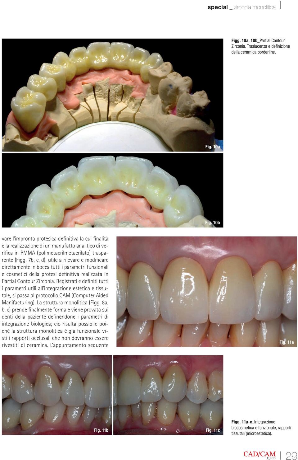 7b, c, d), utile a rilevare e modificare direttamente in bocca tutti i parametri funzionali e cosmetici della protesi definitiva realizzata in Partial Contour Zirconia.