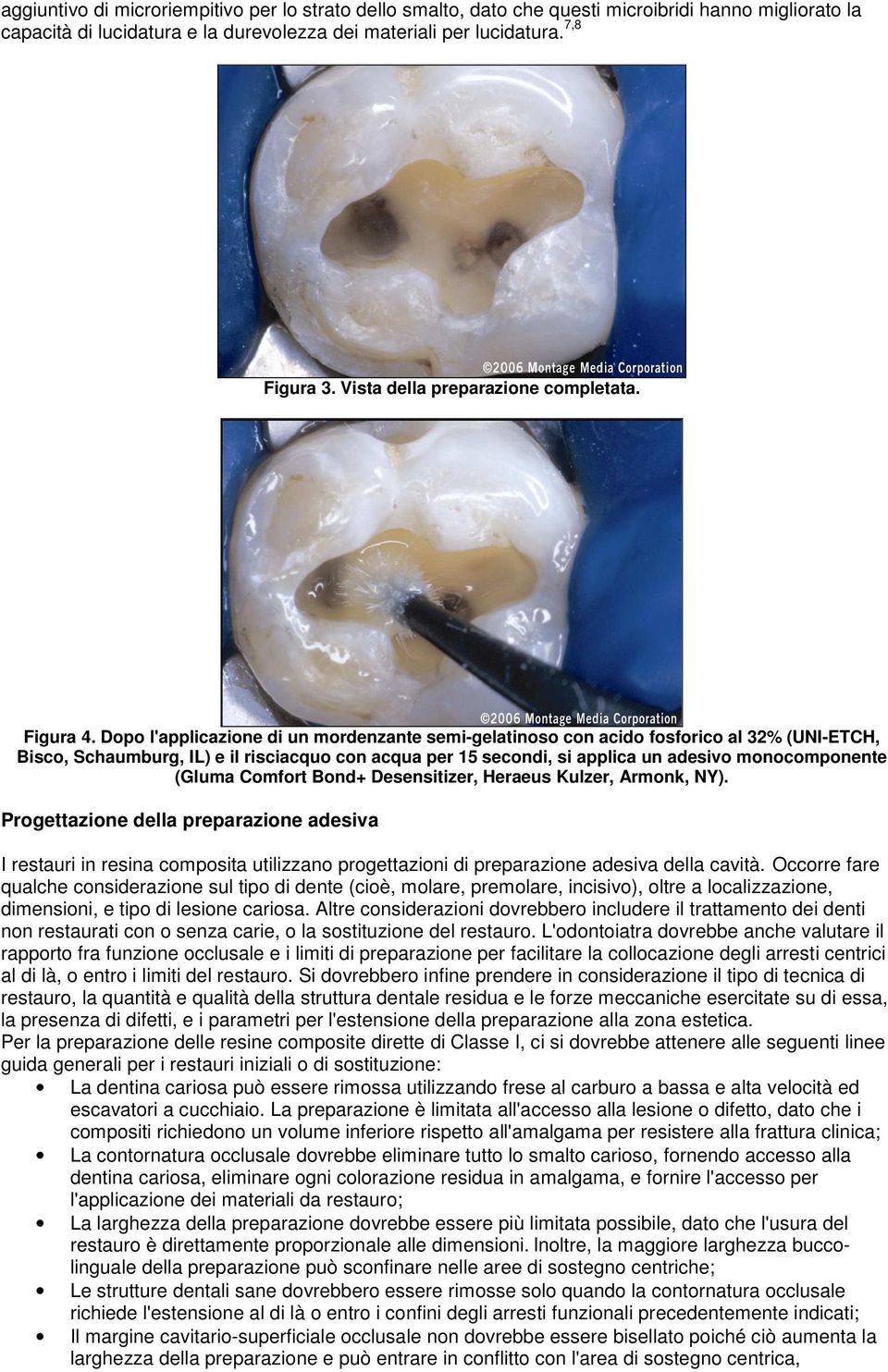 Dopo l'applicazione di un mordenzante semi-gelatinoso con acido fosforico al 32% (UNI-ETCH, Bisco, Schaumburg, IL) e il risciacquo con acqua per 15 secondi, si applica un adesivo monocomponente