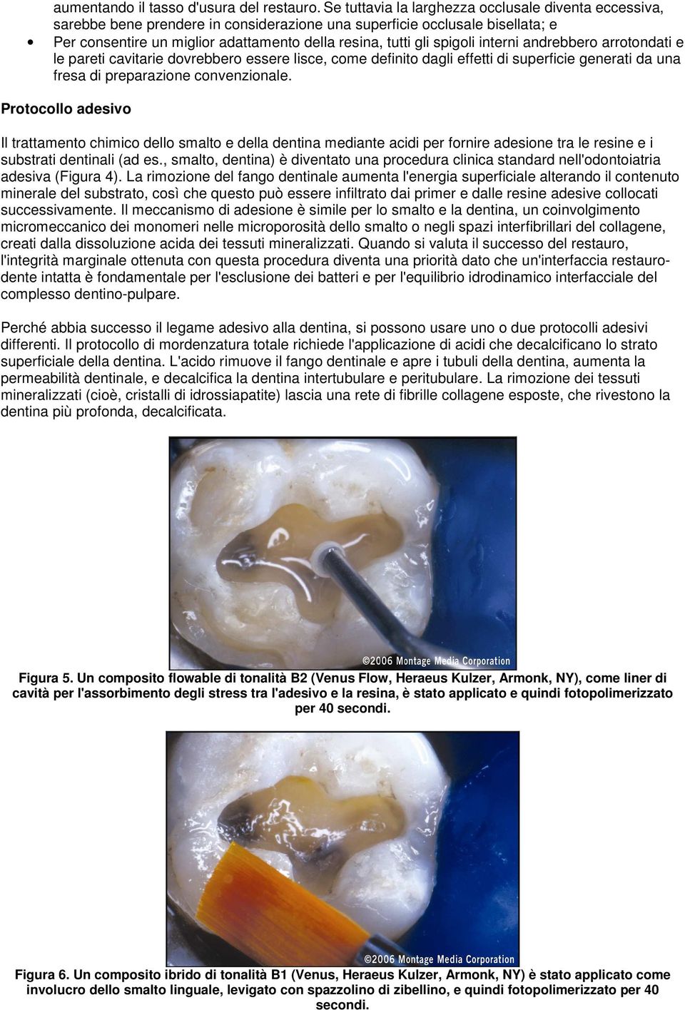 spigoli interni andrebbero arrotondati e le pareti cavitarie dovrebbero essere lisce, come definito dagli effetti di superficie generati da una fresa di preparazione convenzionale.