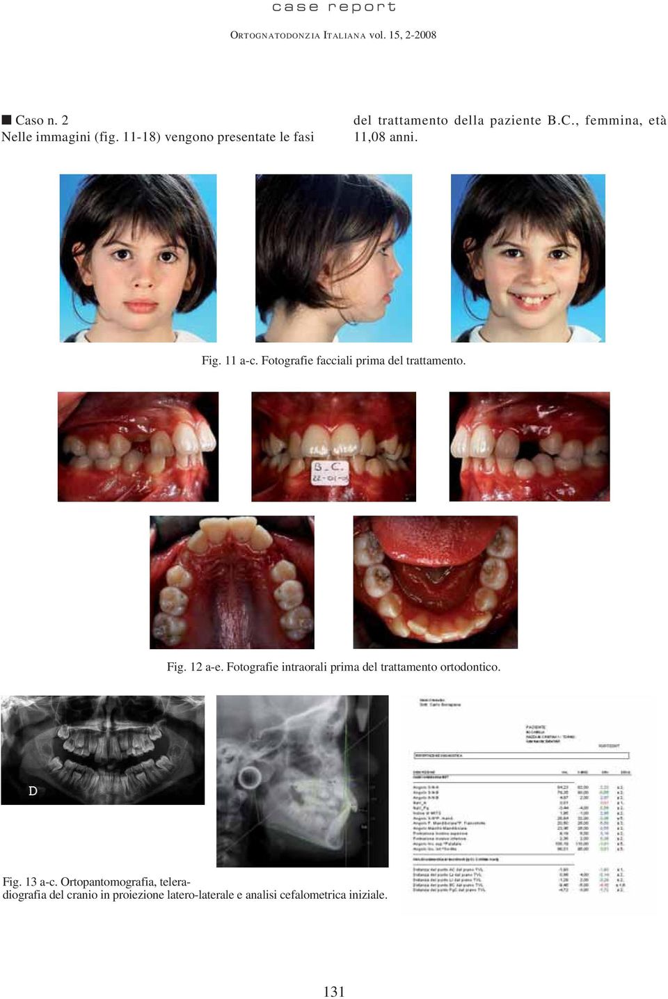 Fig. 11 a-c. Fotografie facciali prima del trattamento. Fig. 12 a-e.