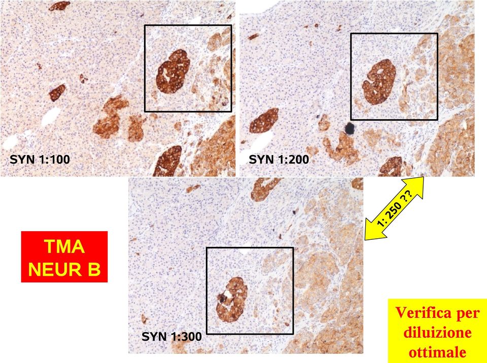 B SYN 1:300 Verifica