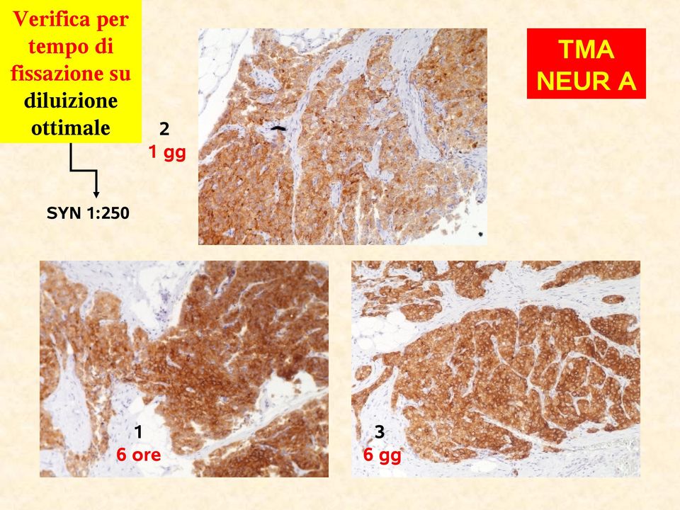 ottimale TMA NEUR A 2 1