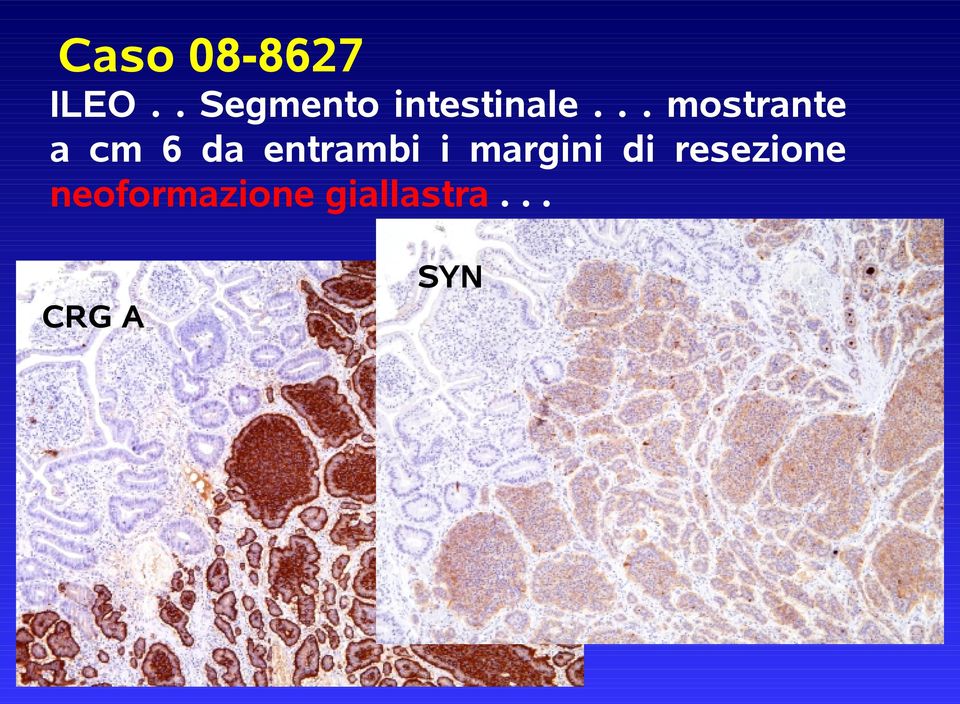 .. mostrante a cm 6 da entrambi i