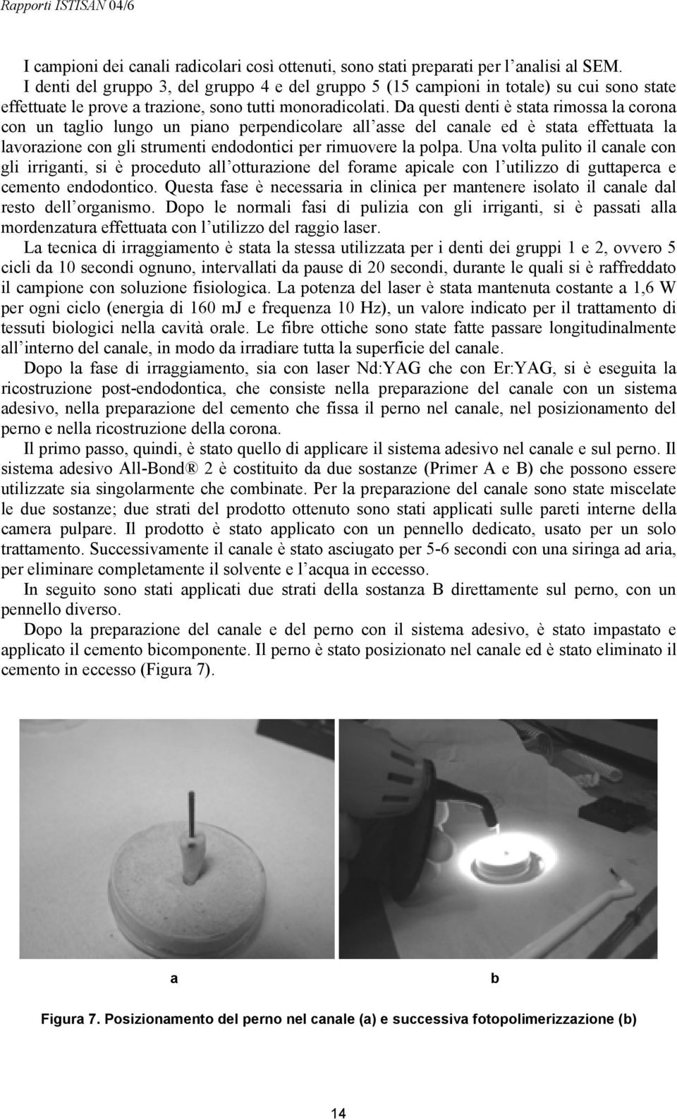 Da questi denti è stata rimossa la corona con un taglio lungo un piano perpendicolare all asse del canale ed è stata effettuata la lavorazione con gli strumenti endodontici per rimuovere la polpa.