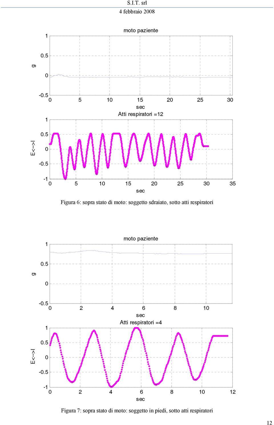 respiratori moto paziente g - 2 4 6 8 Atti respiratori =4 E<-->I - - 2