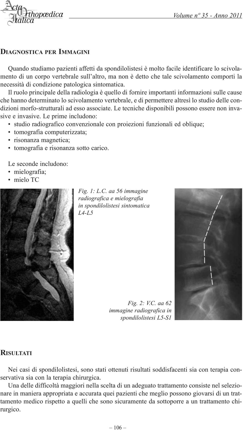 Il ruolo principale della radiologia è quello di fornire importanti informazioni sulle cause che hanno determinato lo scivolamento vertebrale, e di permettere altresì lo studio delle condizioni