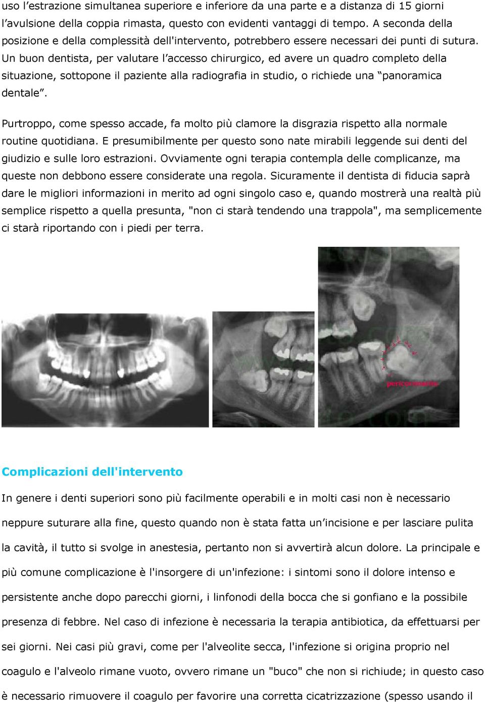 Un buon dentista, per valutare l accesso chirurgico, ed avere un quadro completo della situazione, sottopone il paziente alla radiografia in studio, o richiede una panoramica dentale.