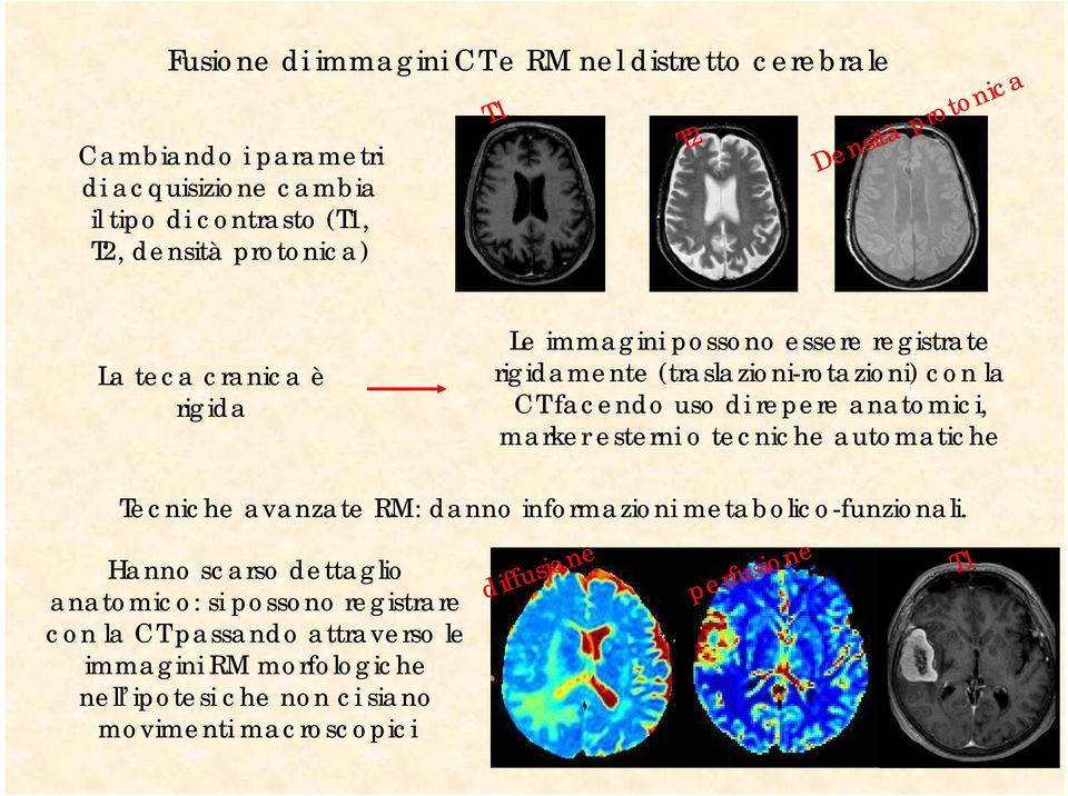 anatomici, marker esterni o tecniche automatiche Tecniche avanzate RM: danno informazioni metabolico-funzionali.