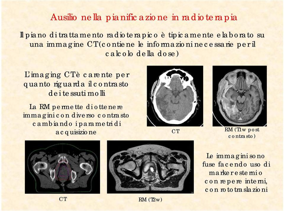 dei tessuti molli La RM permette di ottenere immagini con diverso contrasto cambiando i parametri di acquisizione CT RM