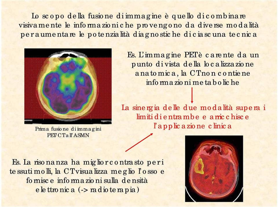 L immagine PET è carente da un punto di vista della localizzazione anatomica, la CT non contiene informazioni metaboliche Prima fusione di immagini