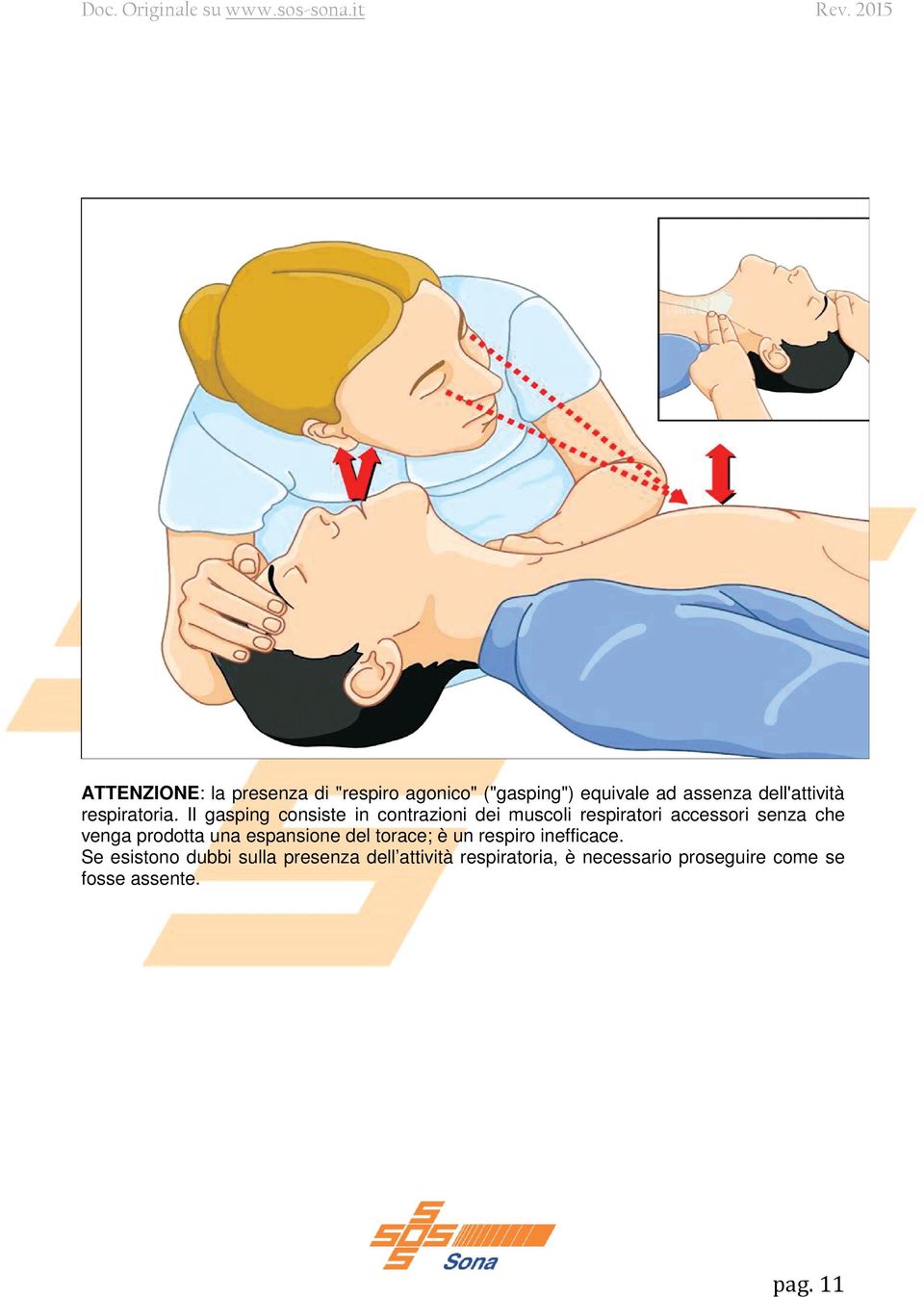 Il gasping consiste in contrazioni dei muscoli respiratori accessori senza che venga