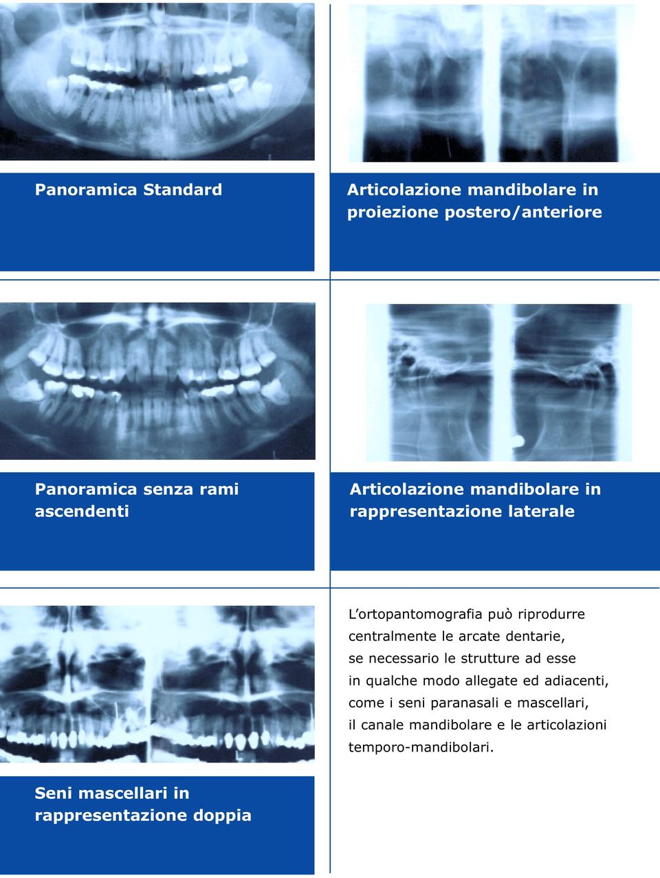 dentarie, se necessario le strutture ad esse in qualche modo allegate ed adiacenti, come i seni paranasali e