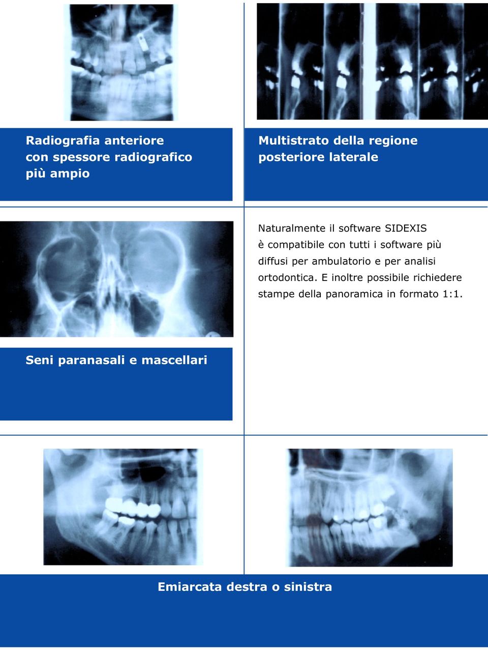 più diffusi per ambulatorio e per analisi ortodontica.