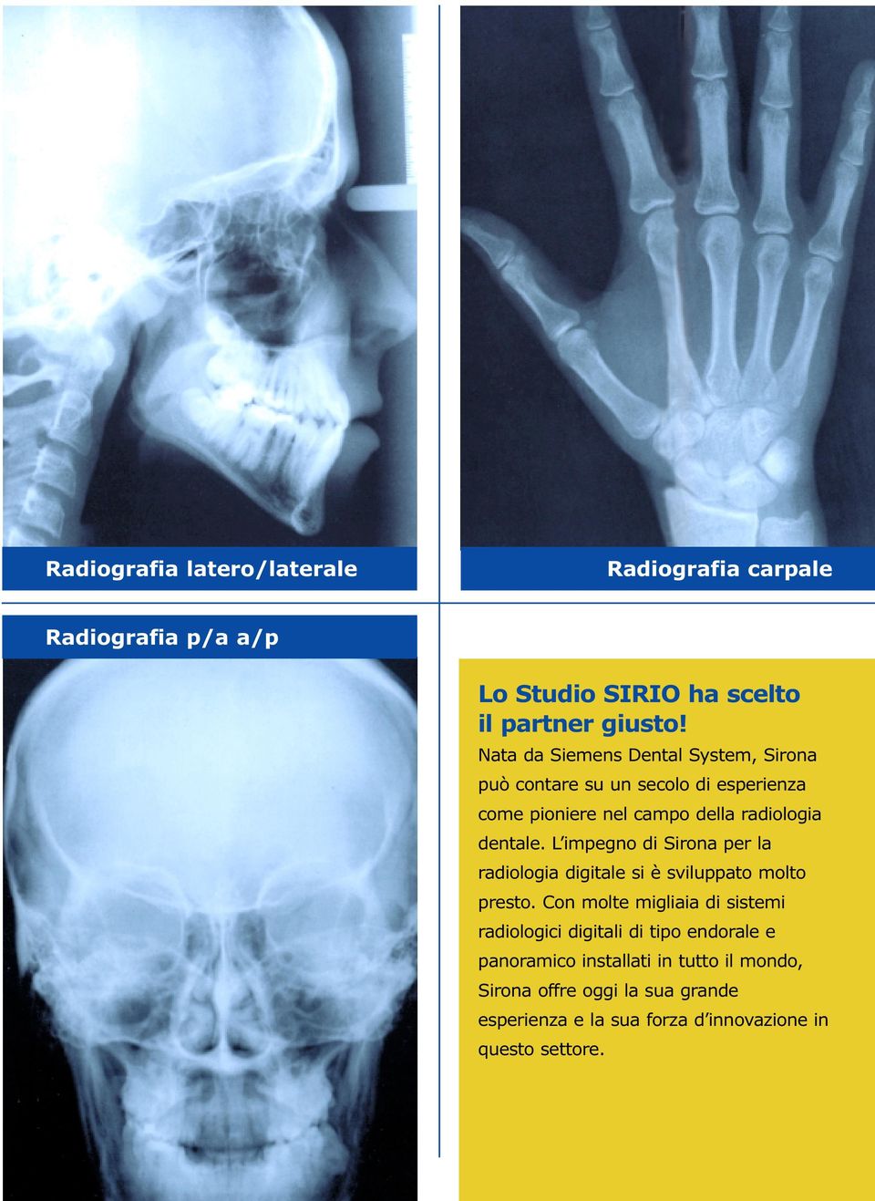 L impegno di Sirona per la radiologia digitale si è sviluppato molto presto.
