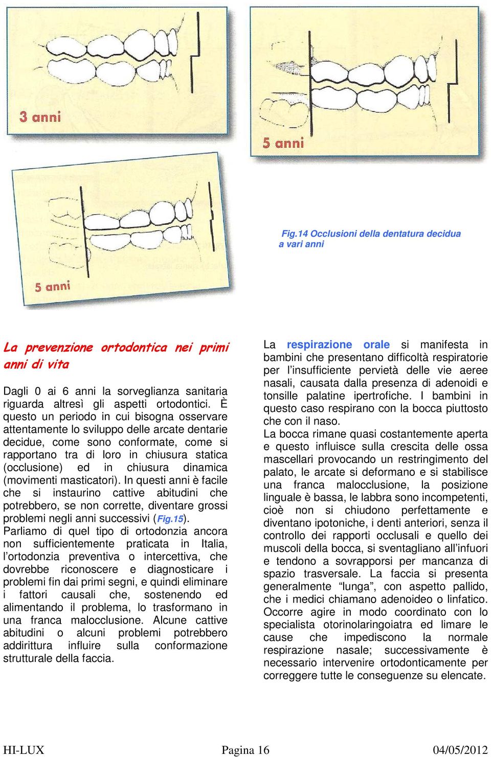 chiusura dinamica (movimenti masticatori). In questi anni è facile che si instaurino cattive abitudini che potrebbero, se non corrette, diventare grossi problemi negli anni successivi (Fig.15).