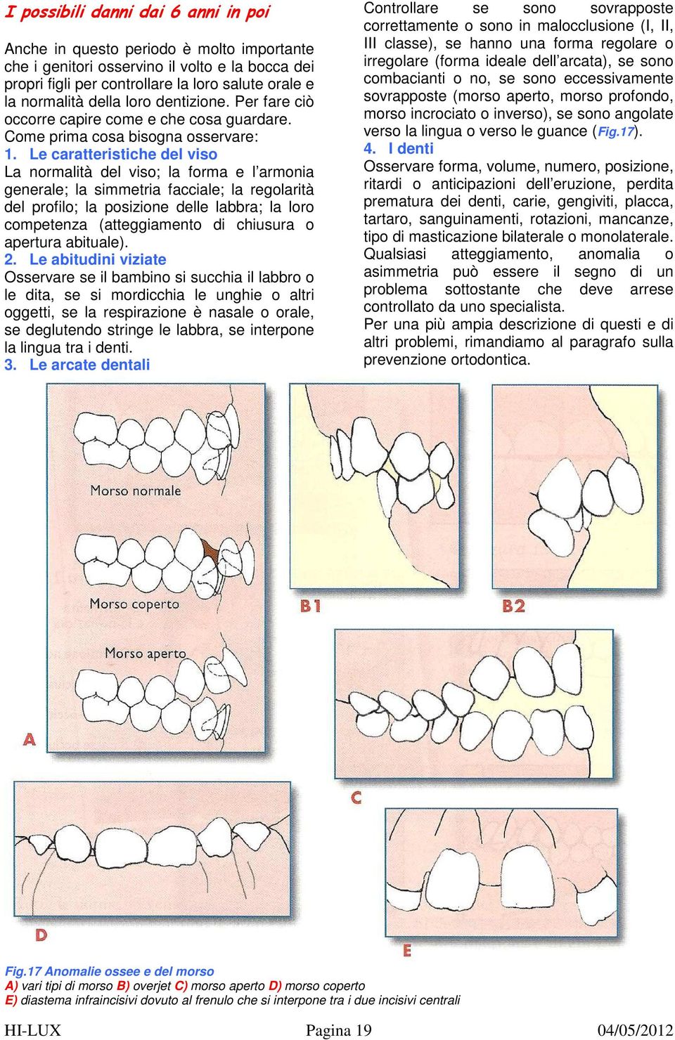 Le caratteristiche del viso La normalità del viso; la forma e l armonia generale; la simmetria facciale; la regolarità del profilo; la posizione delle labbra; la loro competenza (atteggiamento di