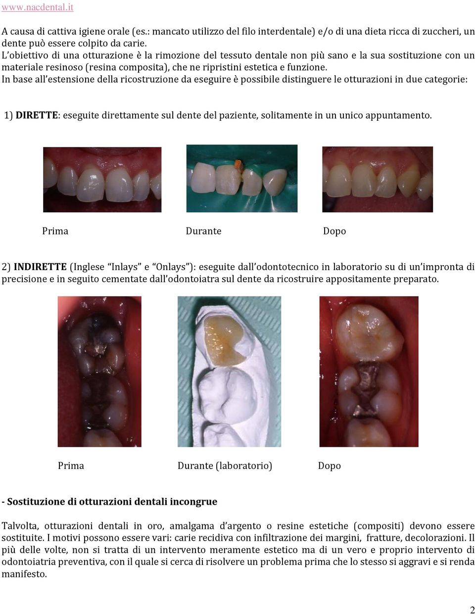 In base all estensione della ricostruzione da eseguire è possibile distinguere le otturazioni in due categorie: 1) DIRETTE: eseguite direttamente sul dente del paziente, solitamente in un unico