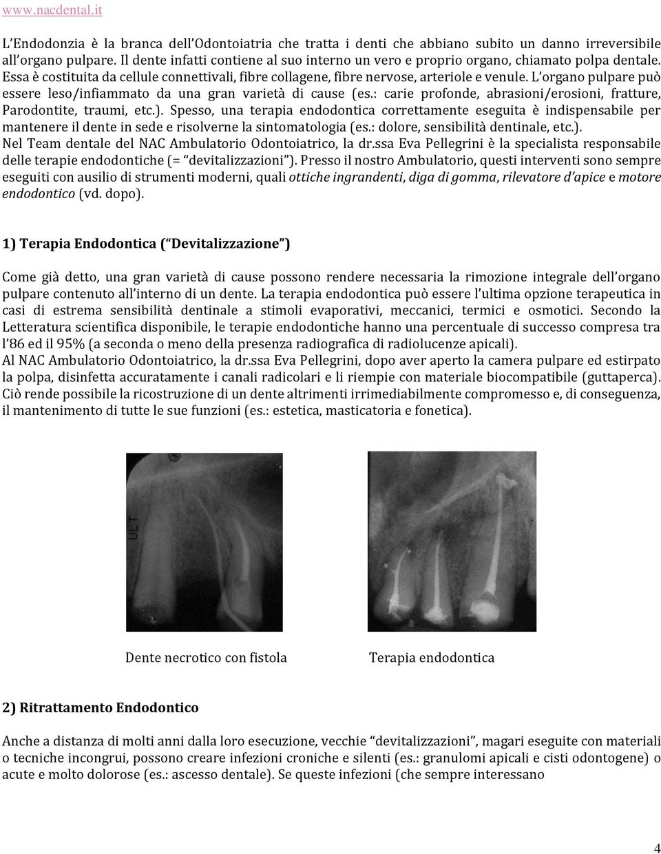 L organo pulpare può essere leso/infiammato da una gran varietà di cause (es.: carie profonde, abrasioni/erosioni, fratture, Parodontite, traumi, etc.).