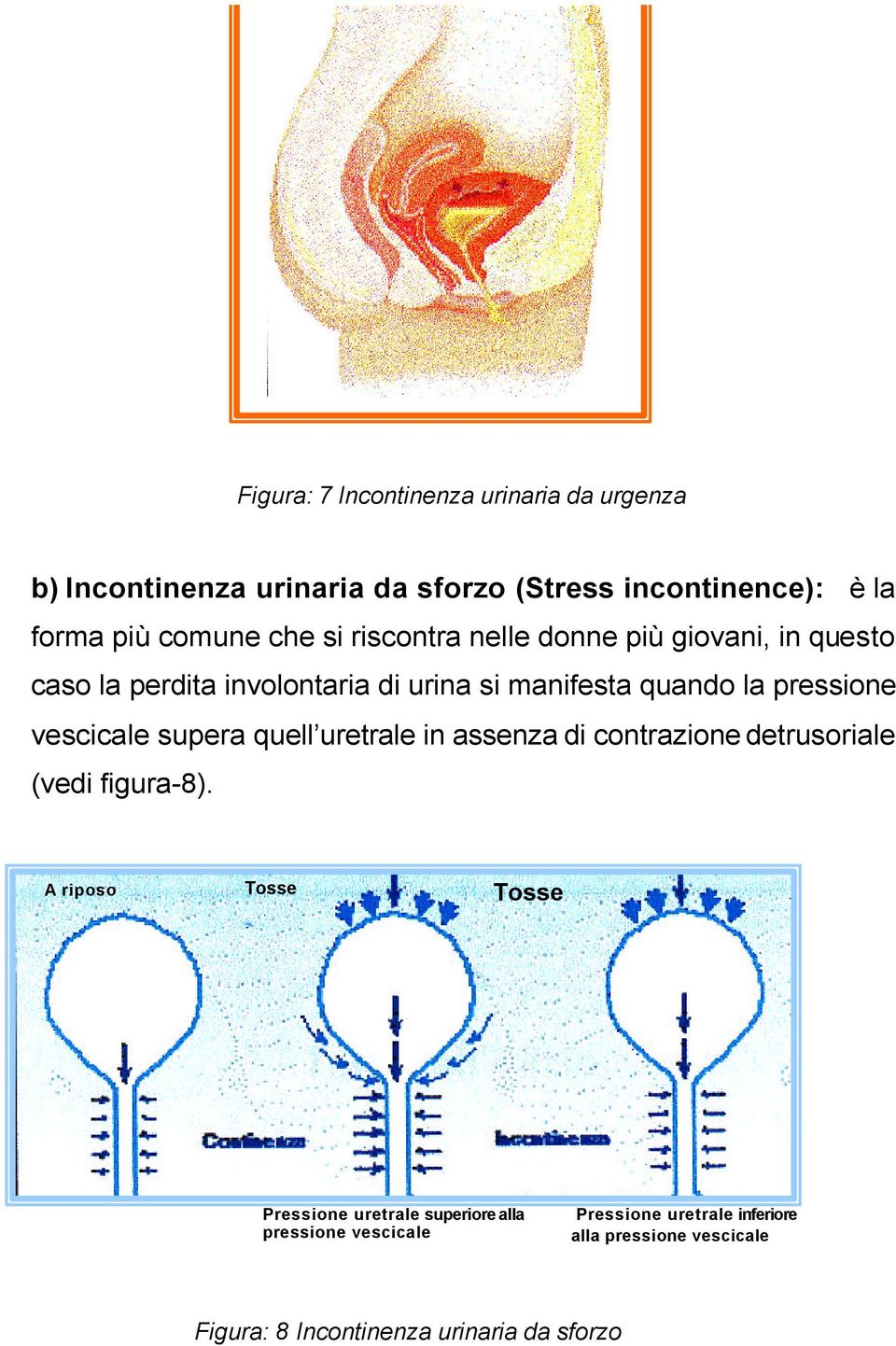 vescicale supera quell uretrale in assenza di contrazione detrusoriale (vedi figura-8).