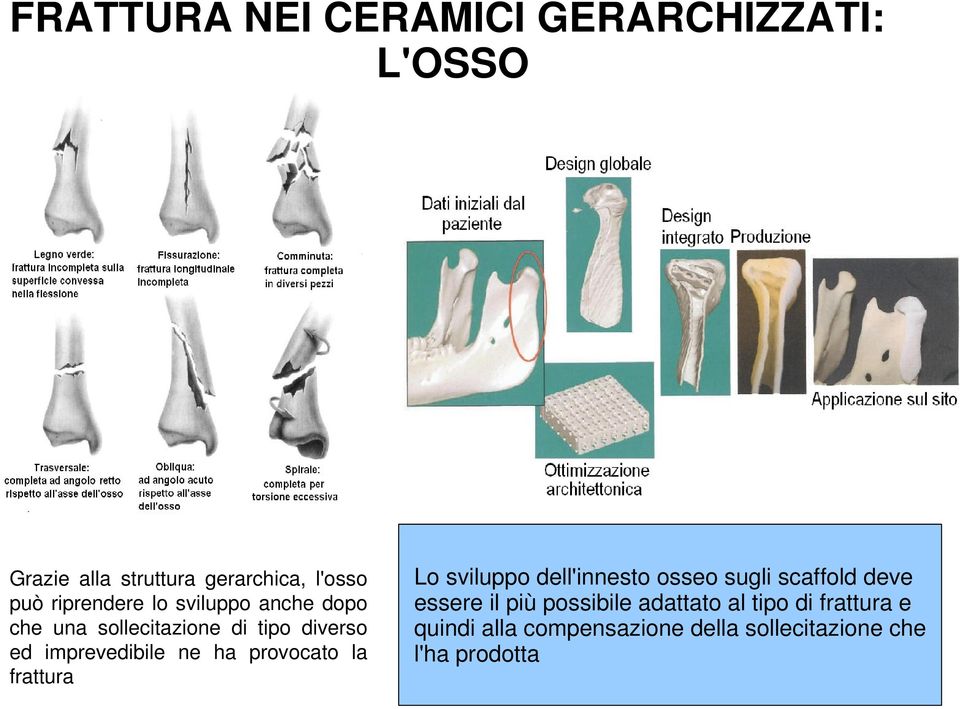 imprevedibile ne ha provocato la frattura Losviluppodell'innestoosseosugliscaffolddeve