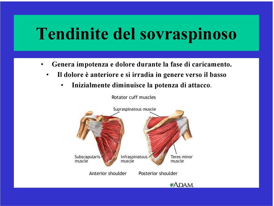 Il dolore è anteriore e si irradia in genere