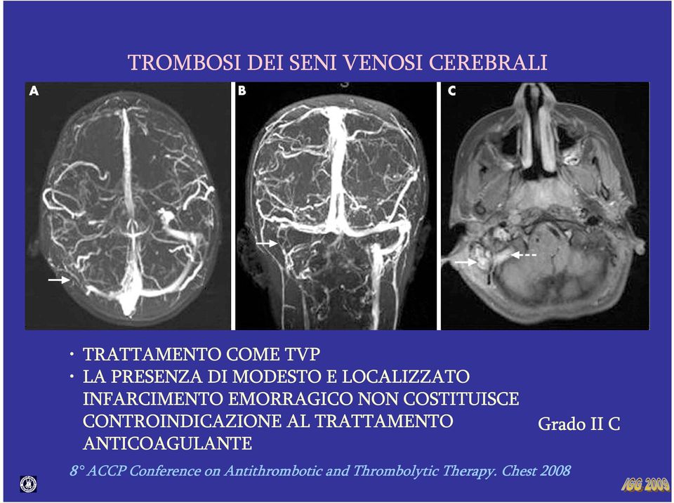 COSTITUISCE CONTROINDICAZIONE AL TRATTAMENTO Grado II C