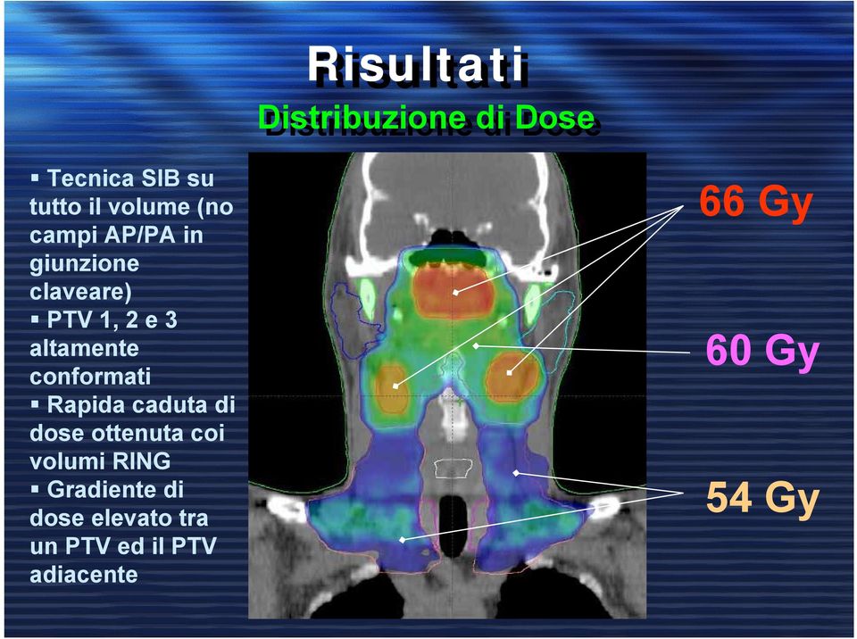 altamente conformati Rapida caduta di dose ottenuta coi volumi