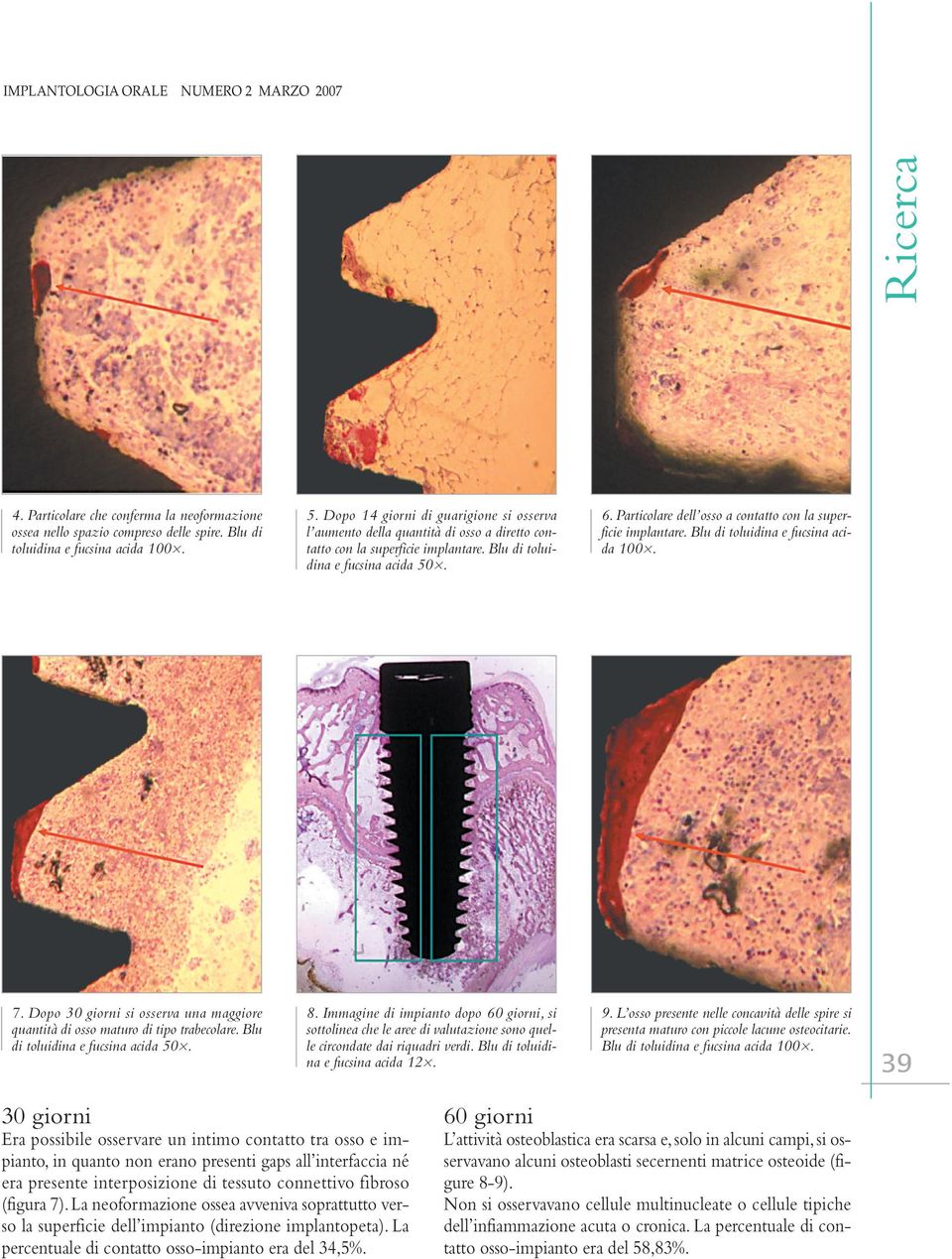 Particolare dell osso a contatto con la superficie implantare. Blu di toluidina e fucsina acida 100. 7. Dopo 30 giorni si osserva una maggiore quantità di osso maturo di tipo trabecolare.