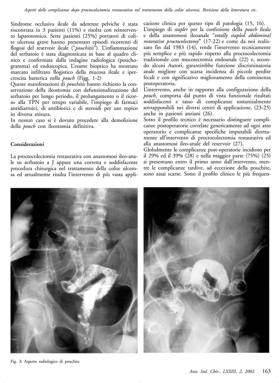 Sette pazienti (25%) portatori di colite ulcerosa grave hanno presentato episodi ricorrenti di flogosi del reservoir ileale ( pouchitis ).