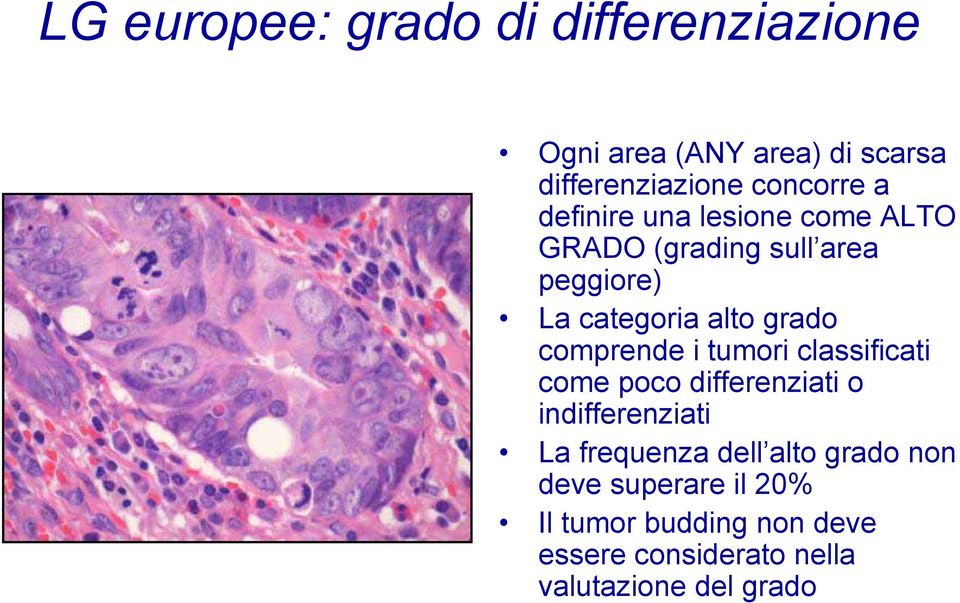 comprende i tumori classificati come poco differenziati o indifferenziati La frequenza dell alto