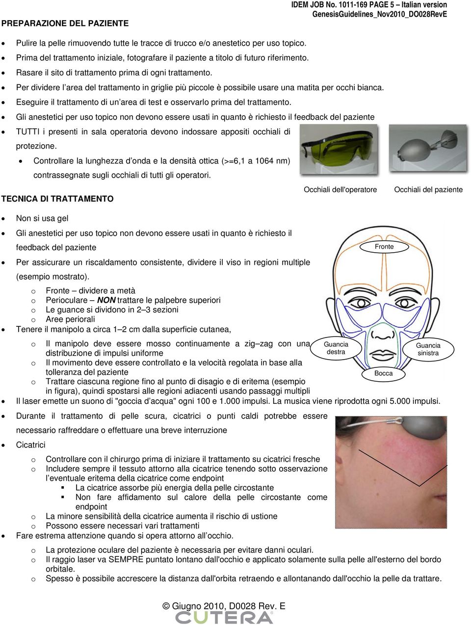 Per dividere l area del trattamento in griglie più piccole è possibile usare una matita per occhi bianca. Eseguire il trattamento di un area di test e osservarlo prima del trattamento.