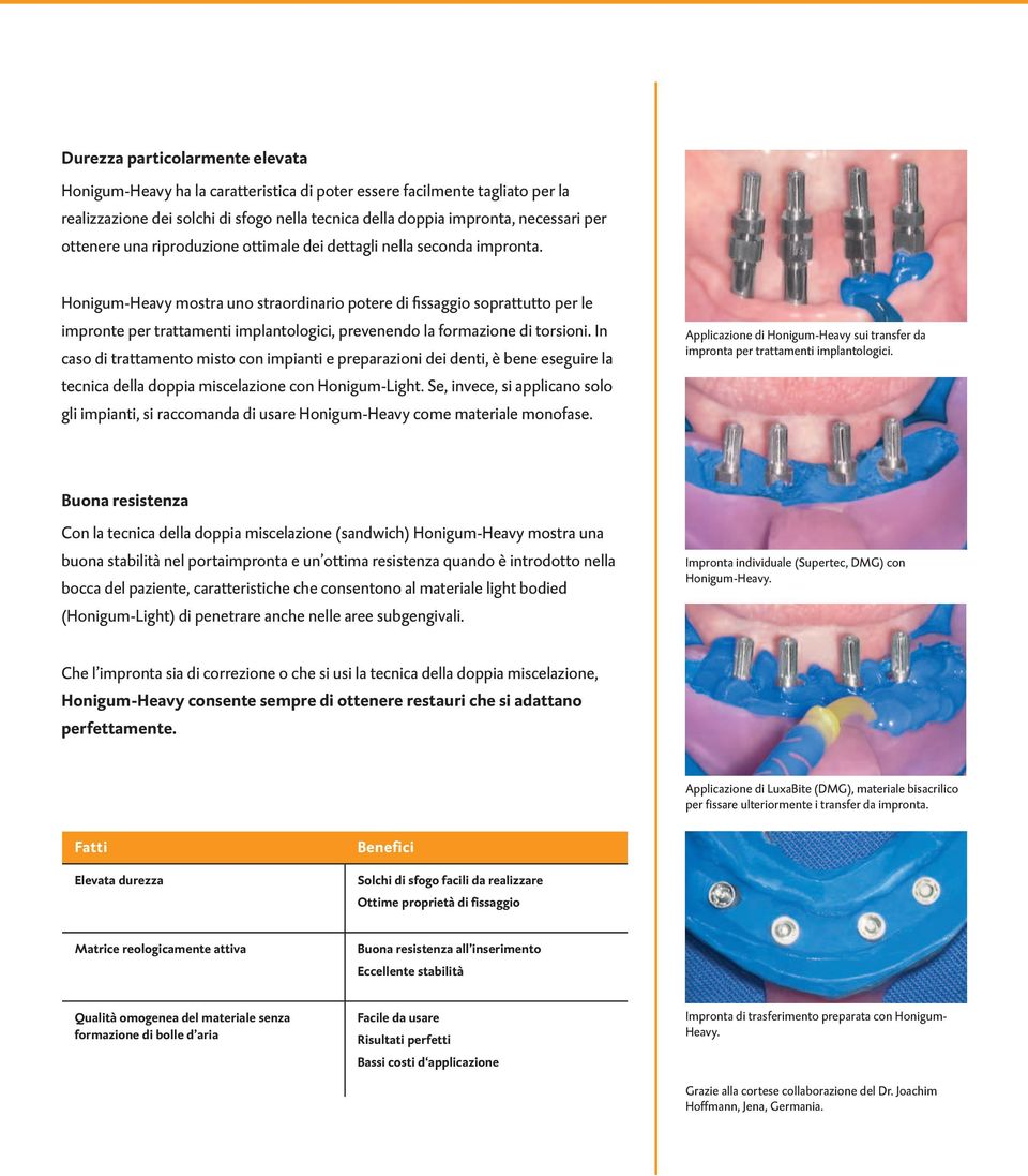 Honigum-Heavy mostra uno straordinario potere di fissaggio soprattutto per le impronte per trattamenti implantologici, prevenendo la formazione di torsioni.