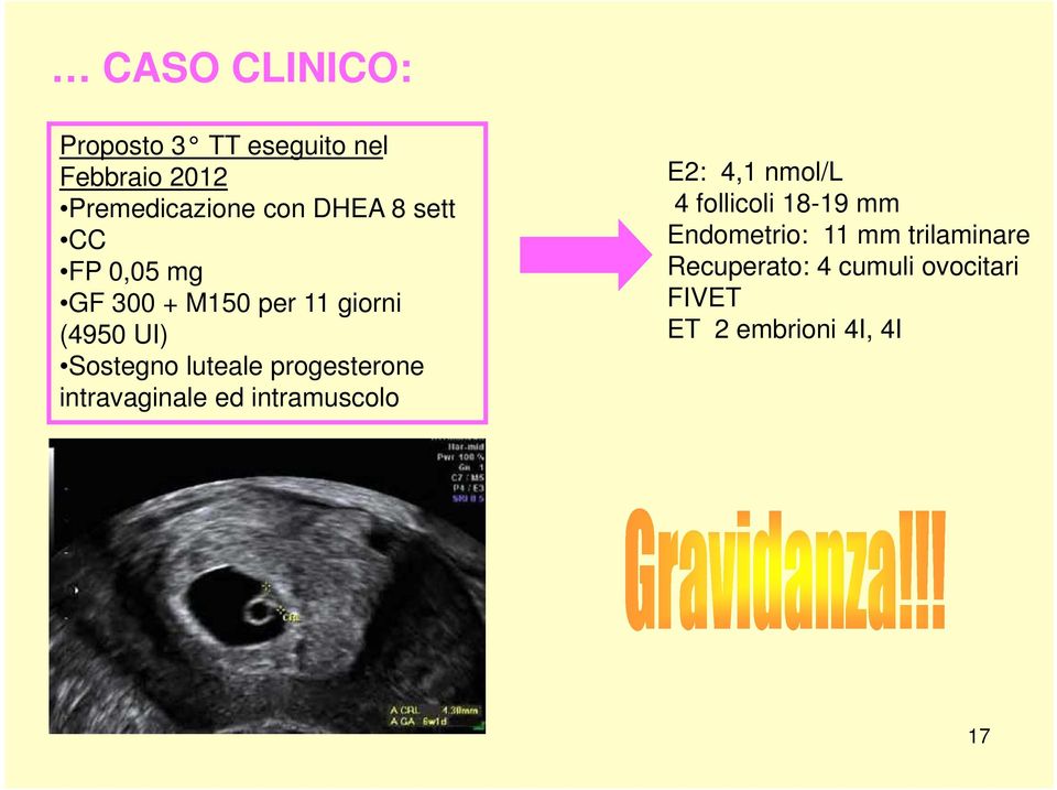 progesterone intravaginale ed intramuscolo E2: 4,1 nmol/l 4 follicoli 18-19 mm