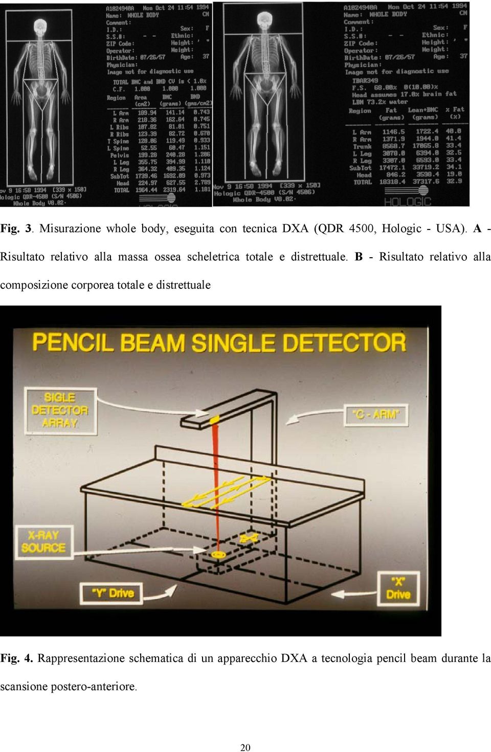 B - Risultato relativo alla composizione corporea totale e distrettuale Fig. 4.