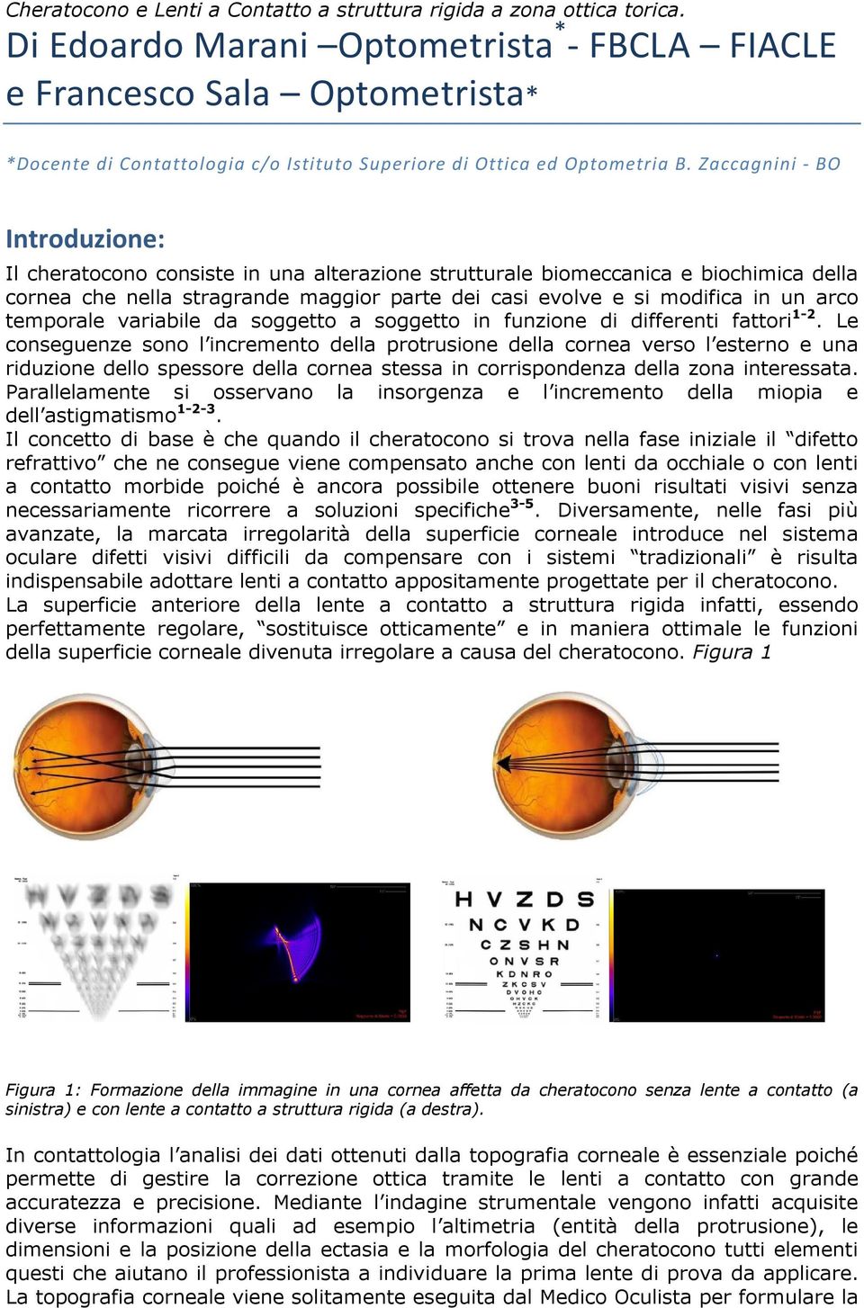 Zaccagnini - BO Introduzione: Il cheratocono consiste in una alterazione strutturale biomeccanica e biochimica della cornea che nella stragrande maggior parte dei casi evolve e si modifica in un arco