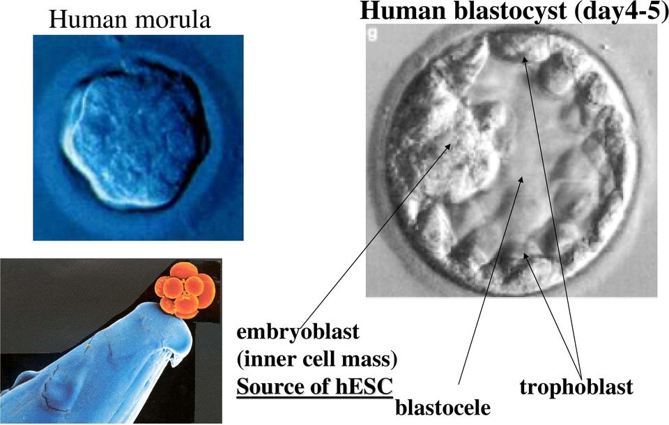 embryoblast (inner cell
