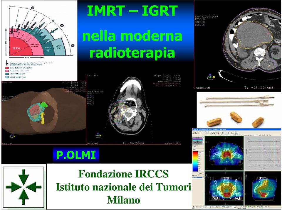 OLMI Fondazione IRCCS