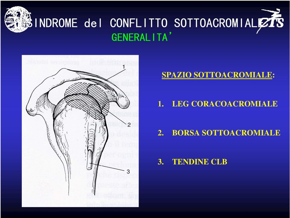 SOTTOACROMIALE: 1.