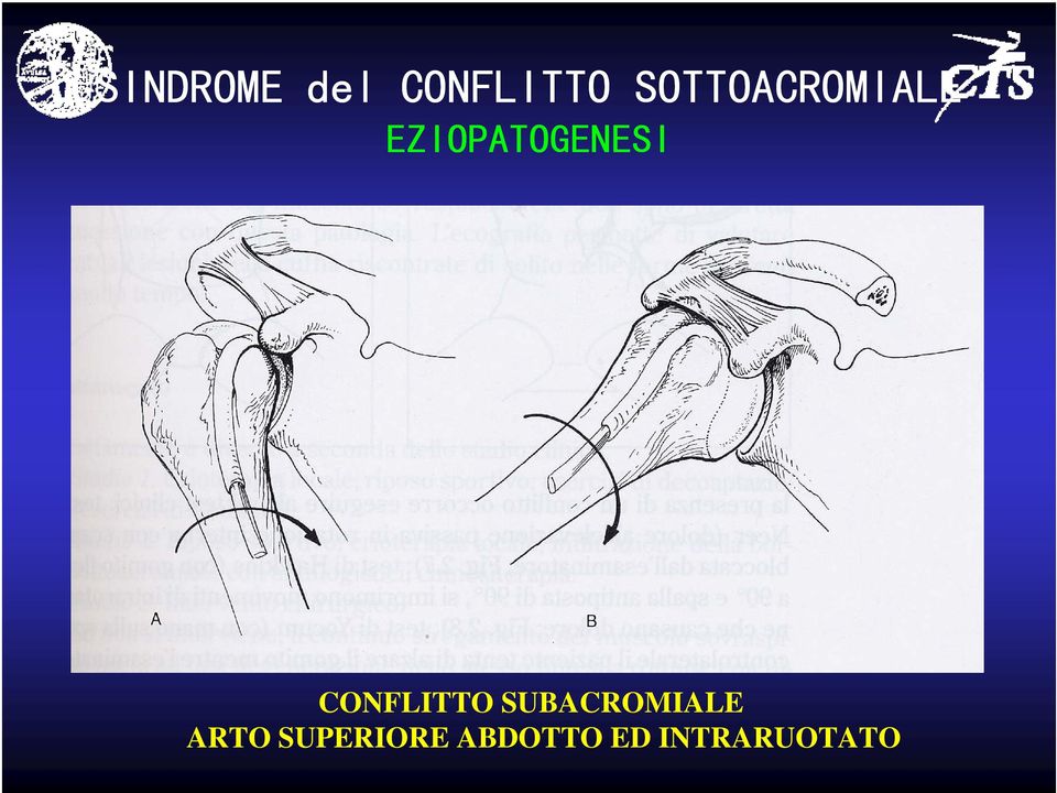 EZIOPATOGENESI CONFLITTO