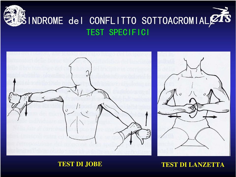 SOTTOACROMIALE TEST