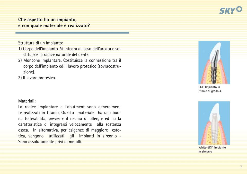 Materiali: La radice implantare e l abutment sono generalmente realizzati in titanio.