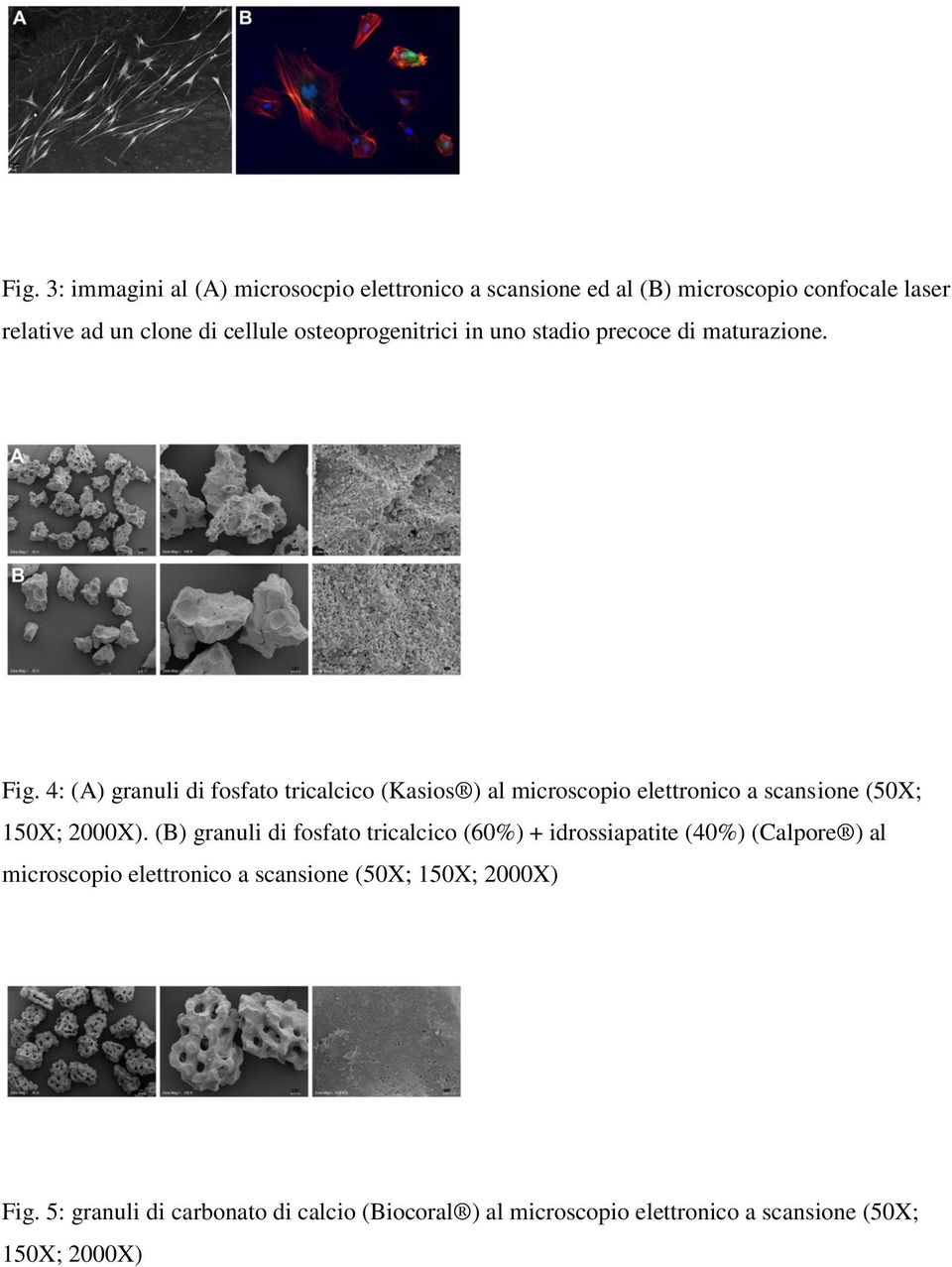 4: (A) granuli di fosfato tricalcico (Kasios ) al microscopio elettronico a scansione (50X; 150X; 2000X).