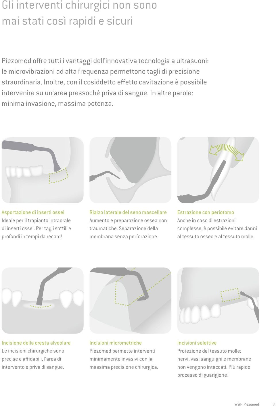 Asportazione di inserti ossei Ideale per il trapianto intraorale di inserti ossei. Per tagli sottili e profondi in tempi da record!